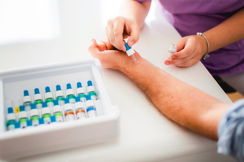 Allergie-Diagnostik / Prick